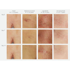 Mark Intenzivní zklidňující krém pro citlivou pleť ekzém i rosaceu 30 ml